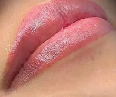 Aquarelle-Lips-After