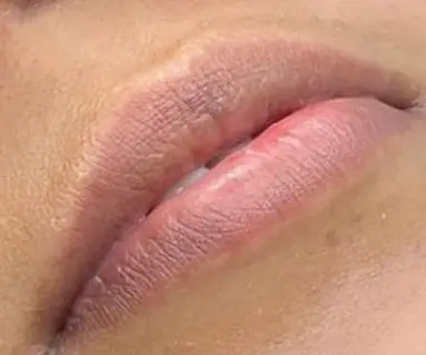Aquarelle-Lips - vorher